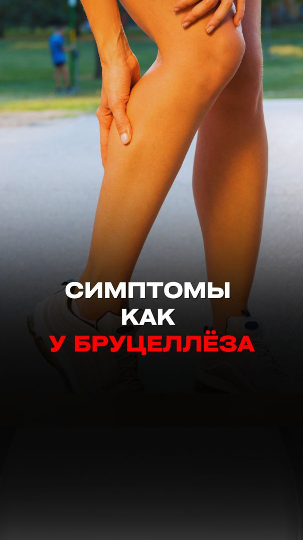 СБН: СИМПТОМЫ КАК У БРУЦЕЛЛЁЗА