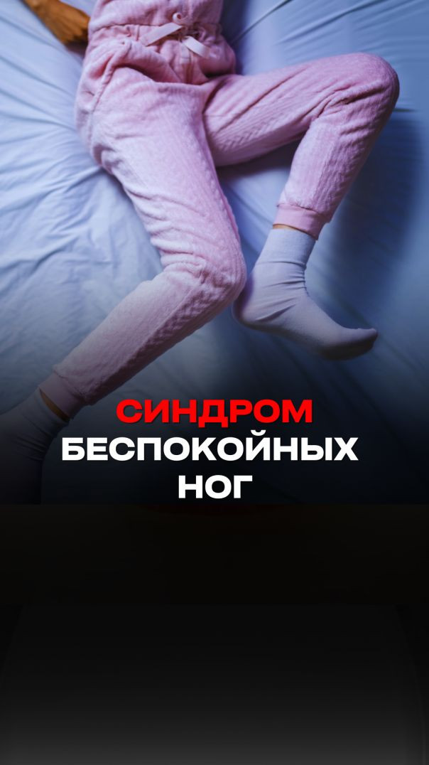 СИНДРОМ БЕСПОКОЙНЫХ НОГ Тизер