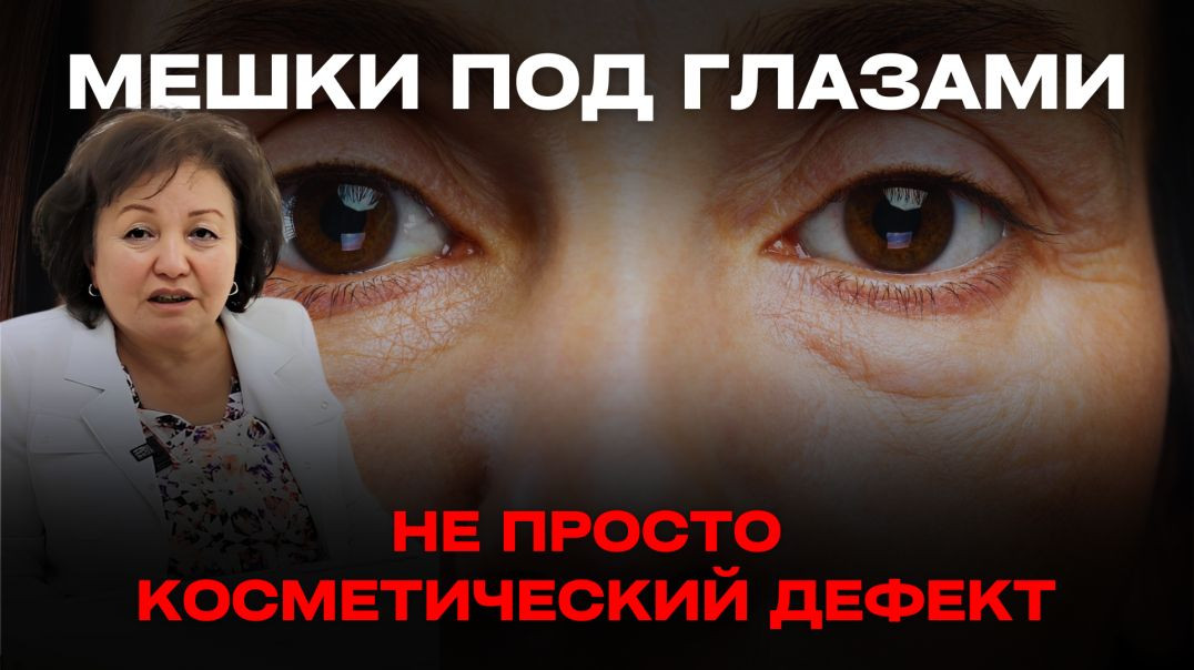 МЕШКИ ПОД ГЛАЗАМИ НЕ ПРОСТО КОСМЕТИЧЕСКИЙ ДЕФЕКТ