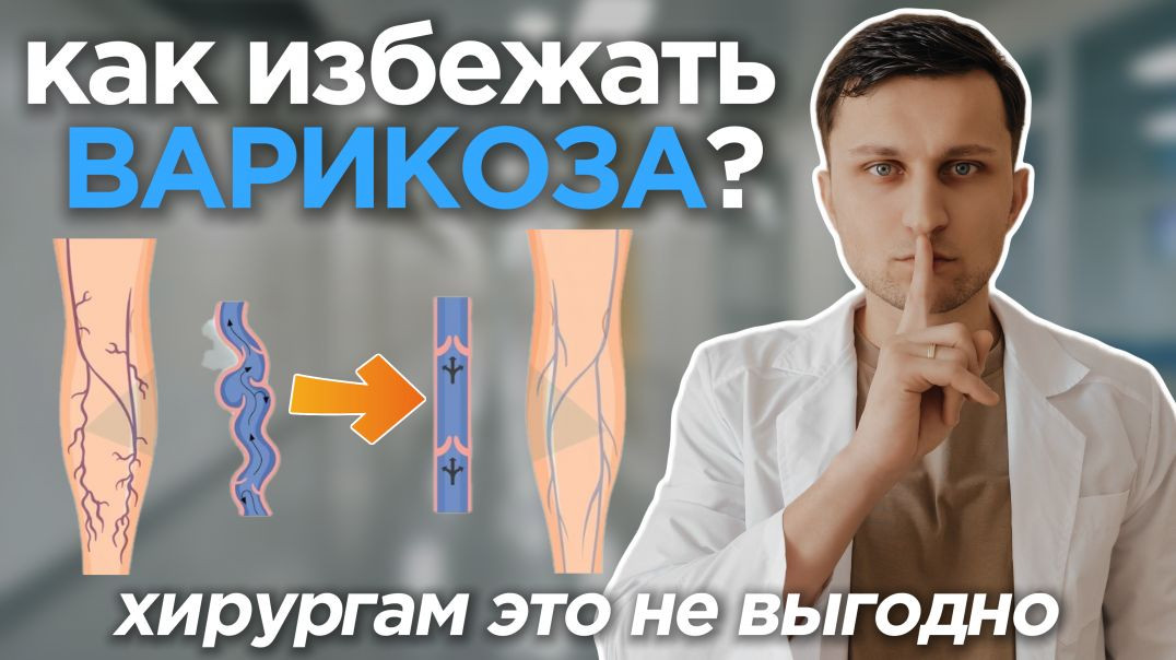 Лучшая профилактика ВАРИКОЗА. Как замедлить развитие варикоза на ногах. Бесплатные методы
