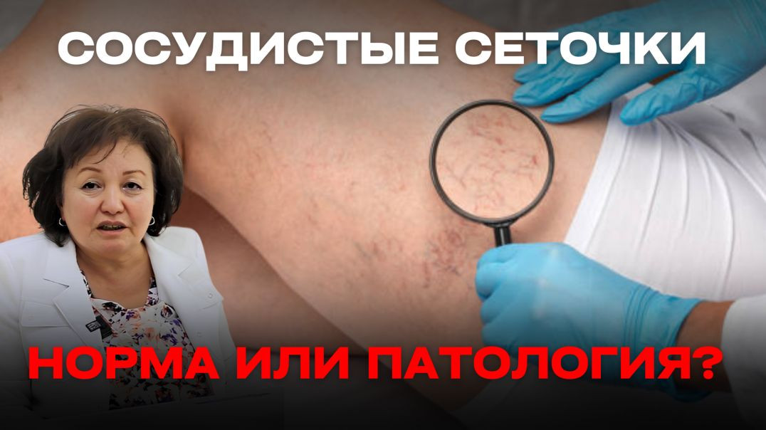 СОСУДИСТЫЕ СЕТОЧКИ: НОРМА ИЛИ ПАТОЛОГИЯ?