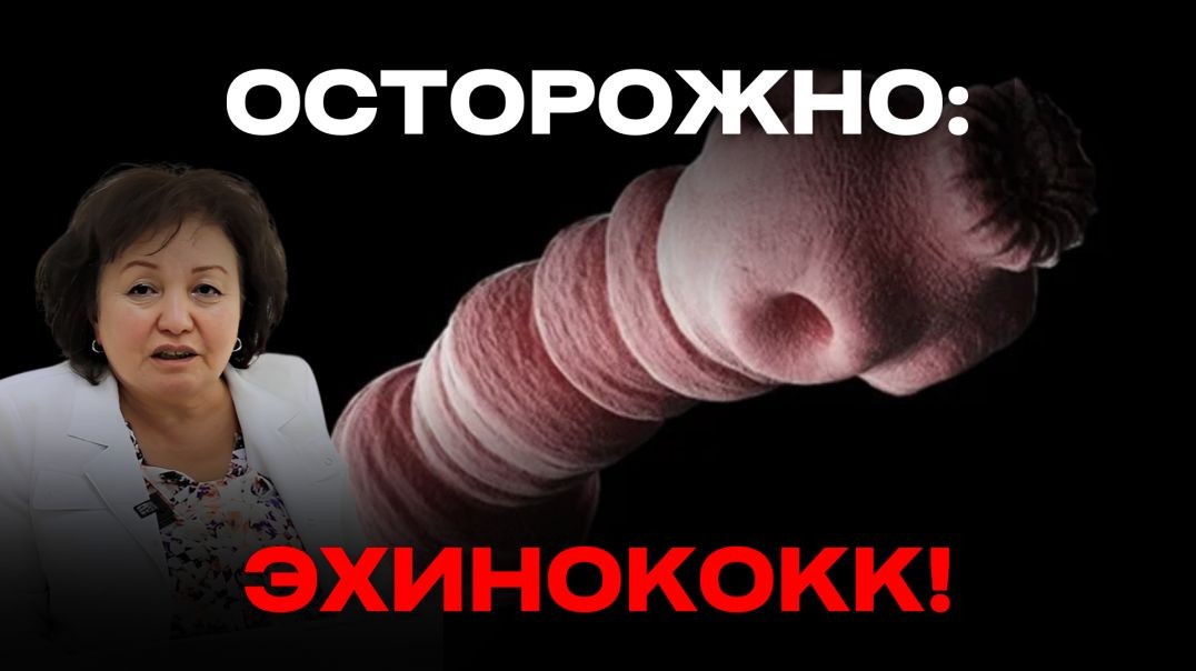 ОСТОРОЖНО: ЭХИНОКОКК!
