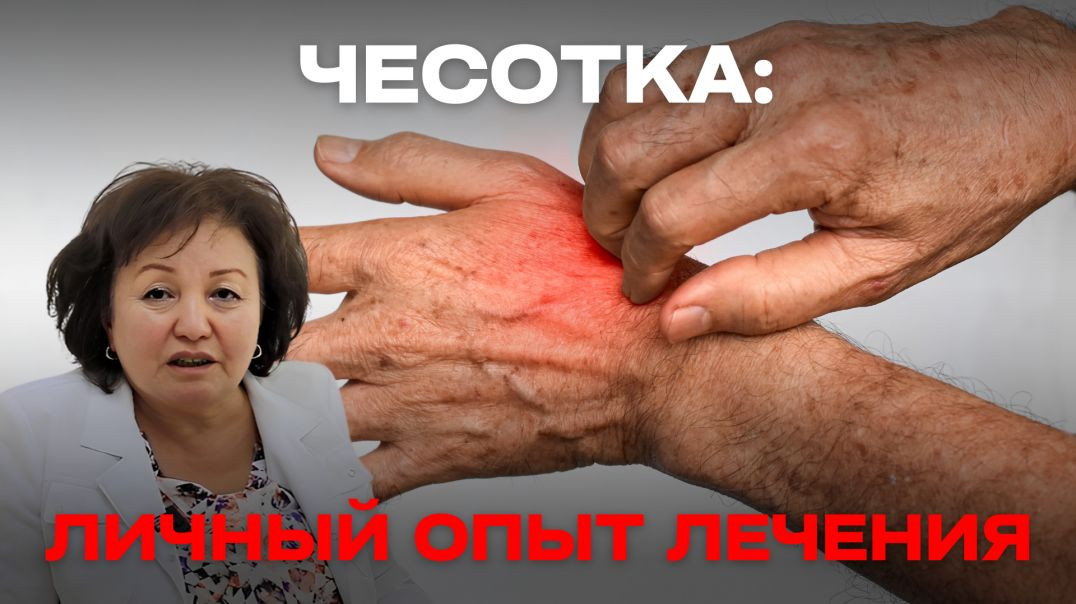ЧЕСОТКА: ЛИЧНЫЙ ОПЫТ ЛЕЧЕНИЯ