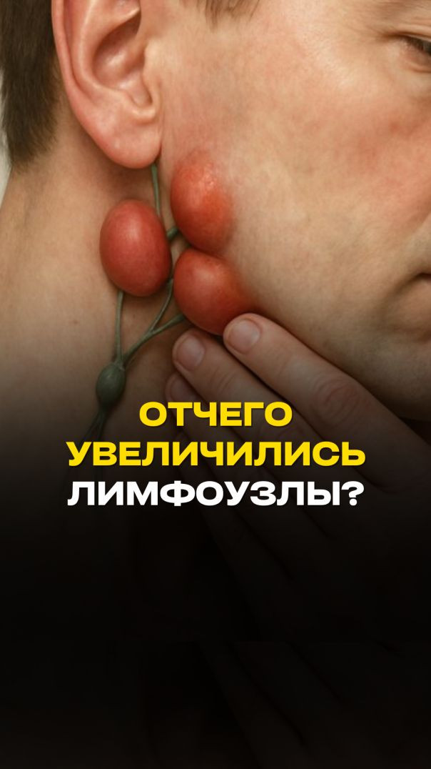 ОТЧЕГО УВЕЛИЧИЛИСЬ ЛИМФОУЗЛЫ?