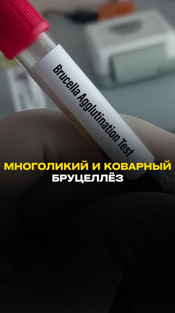 МНОГОЛИКИЙ И КОВАРНЫЙ БРУЦЕЛЛЁЗ