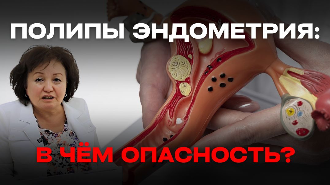 ПОЛИПЫ ЭНДОМЕТРИЯ: В ЧЁМ ОПАСНОСТЬ?