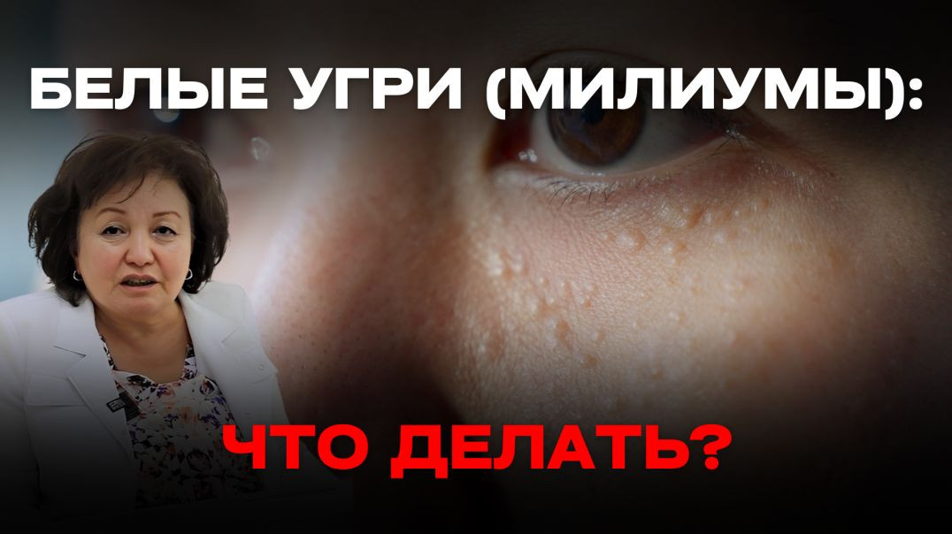 БЕЛЫЕ УГРИ (МИЛИУМЫ): ЧТО ДЕЛАТЬ?