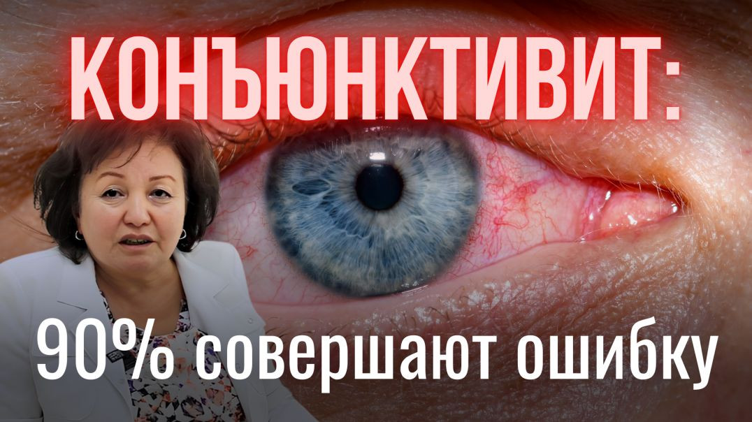 КОНЪЮНКТИВИТ: 90% СОВЕРШАЮТ ОШИБКУ
