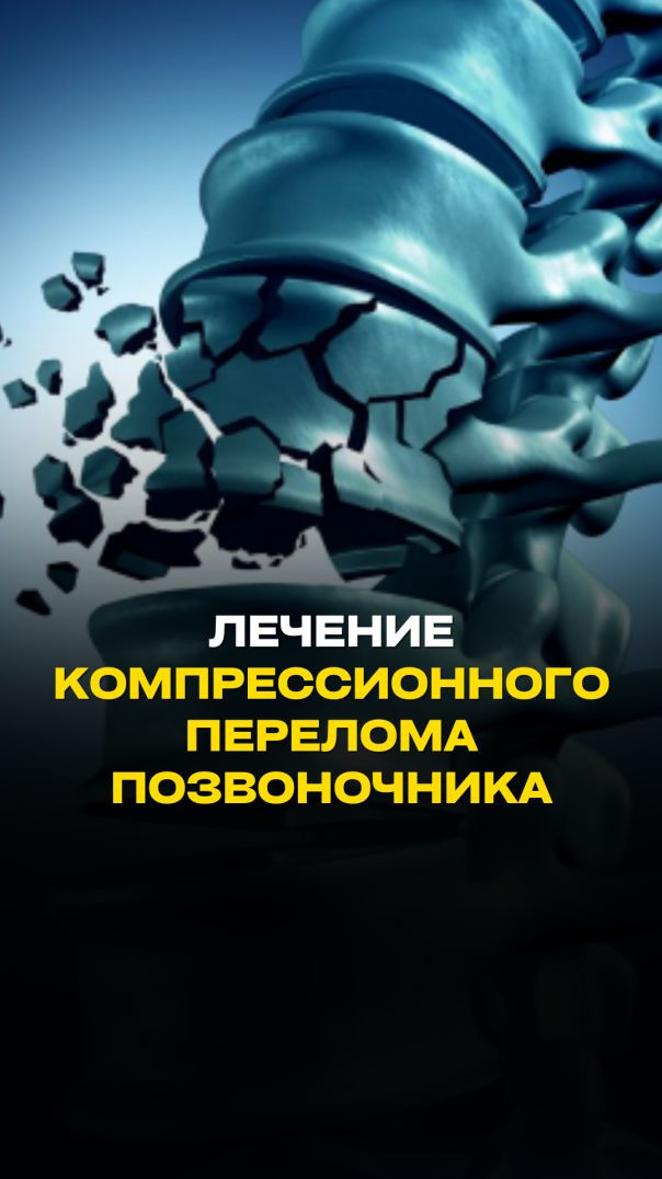 ЛЕЧЕНИЕ КОМПРЕССИОННОГО ПЕРЕЛОМА