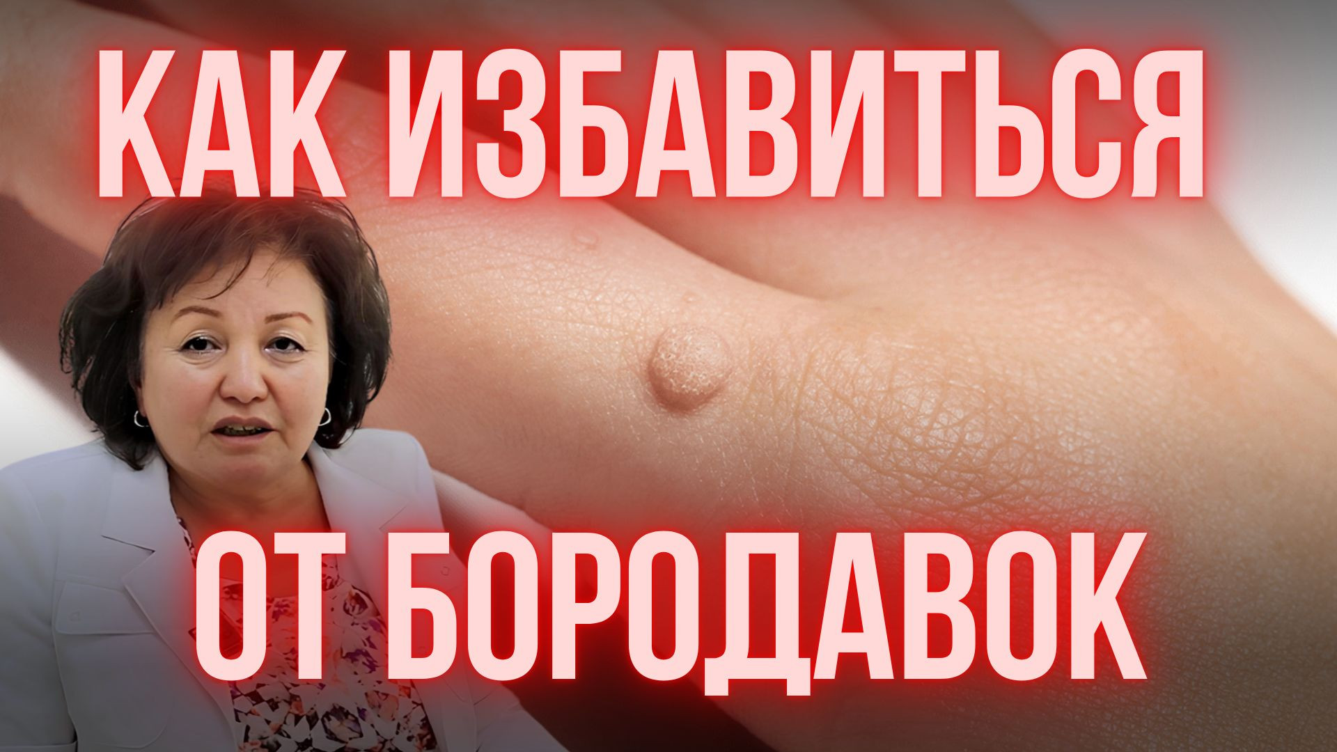 ПОДОШВЕННЫЕ БОРОДАВКИ: КАК ИЗБАВИТЬСЯ ОТ ШИПИЦ