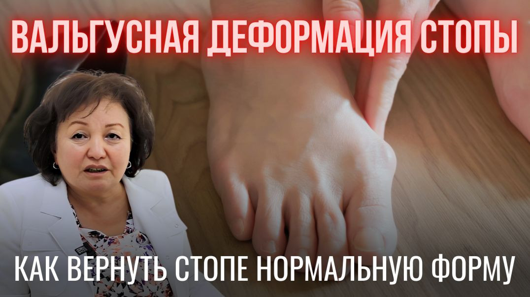 КАК ВЕРНУТЬ СТОПЕ НОРМАЛЬНУЮ ФОРМУ