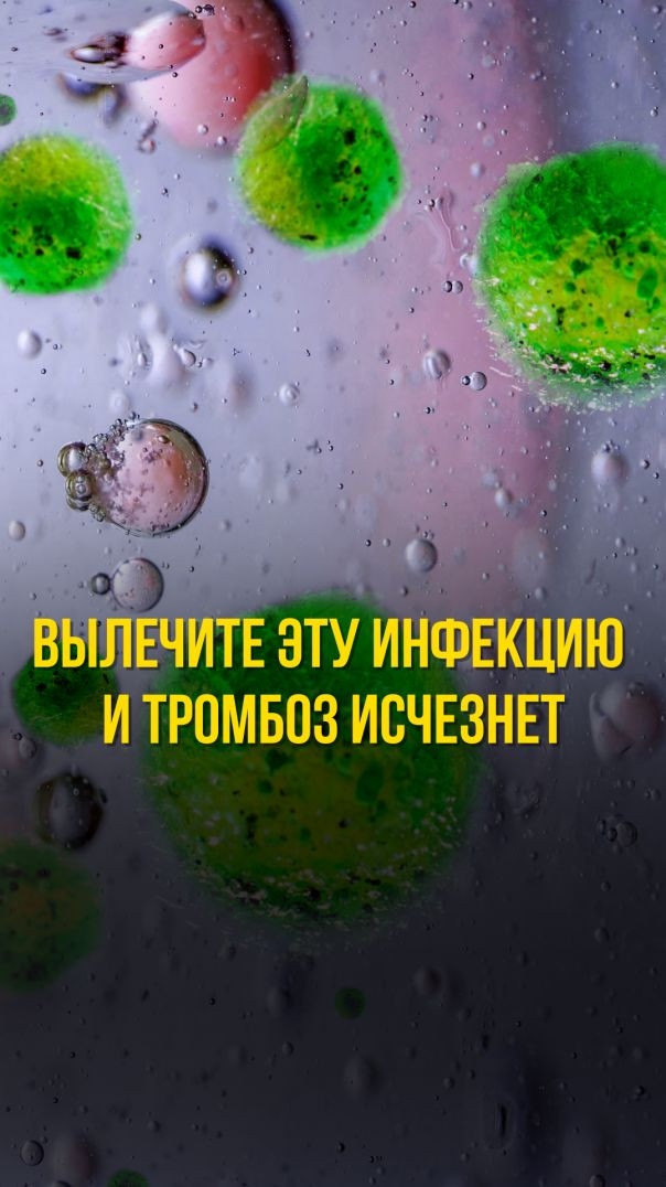 ВЫЛЕЧИТЕ ЭТУ ИНФЕКЦИЮ И ТРОМБОЗ ИСЧЕЗНЕТ