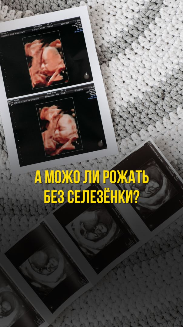 А МОЖО ЛИ РОЖАТЬ БЕЗ СЕЛЕЗЁНКИ?