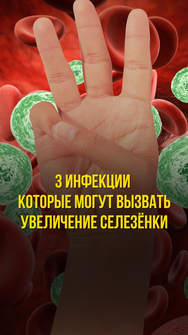 3 ИНФЕКЦИИ КОТОРЫЕ МОГУТ ВЫЗВАТЬ СПЛЕНОМЕГАЛИЮ