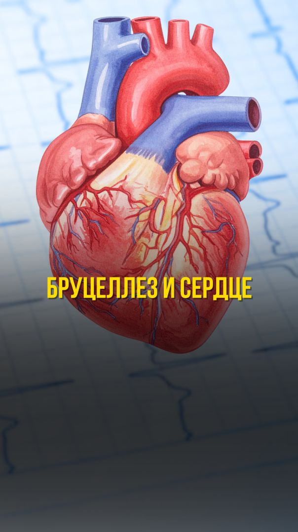 БРУЦЕЛЛЕЗ И СЕРДЦЕ Тизер
