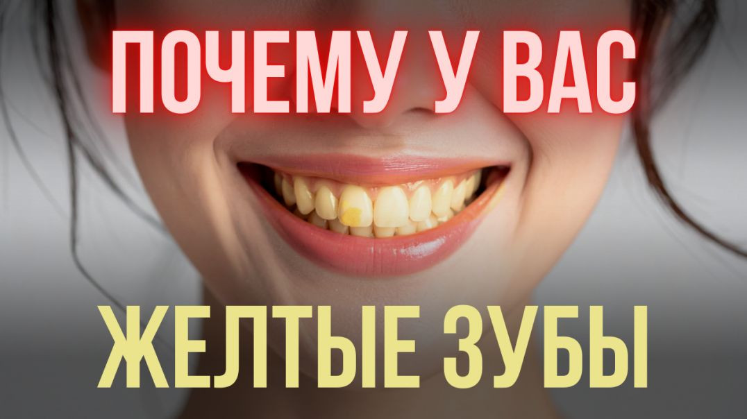 ПОЧЕМУ У ВАС ЖЕЛТЫЕ ЗУБЫ