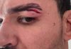 Патрики Питбуль снялся с дебюта в Karate Combat Патрики Питбуль снялся с дебюта в Karate Combat