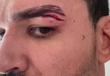 Патрики Питбуль снялся с дебюта в Karate Combat Патрики Питбуль снялся с дебюта в Karate Combat