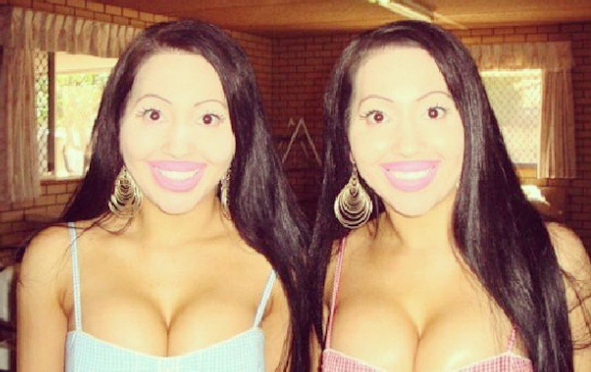 Такими сёстры были после пластических операций. Фото Скриншот Instagram/annalucydecinque