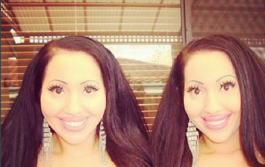 Такими сёстры были после пластических операций. Фото Скриншот Instagram/annalucydecinque