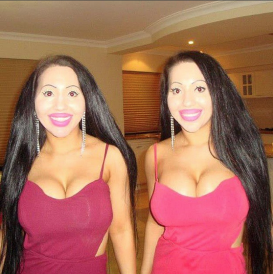 Такими сёстры были после пластических операций. Фото Скриншот Instagram/annalucydecinque