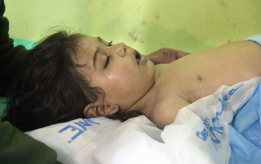 Последствия химатаки в Сирии. Фото AFP