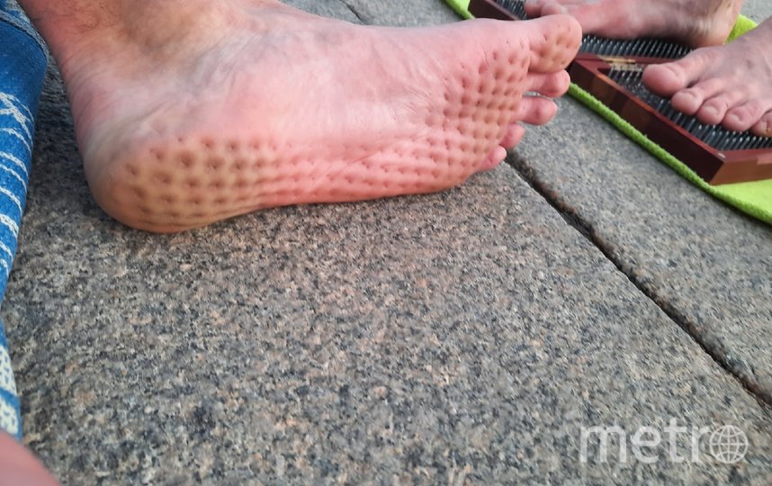 Следы на ступне от долгого стояния на гвоздях. Фото Марк Мордовцев, "Metro"