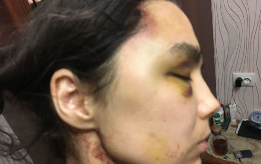 Муж полтора года избивал жену на глазах у маленьких детей в Подмосковье