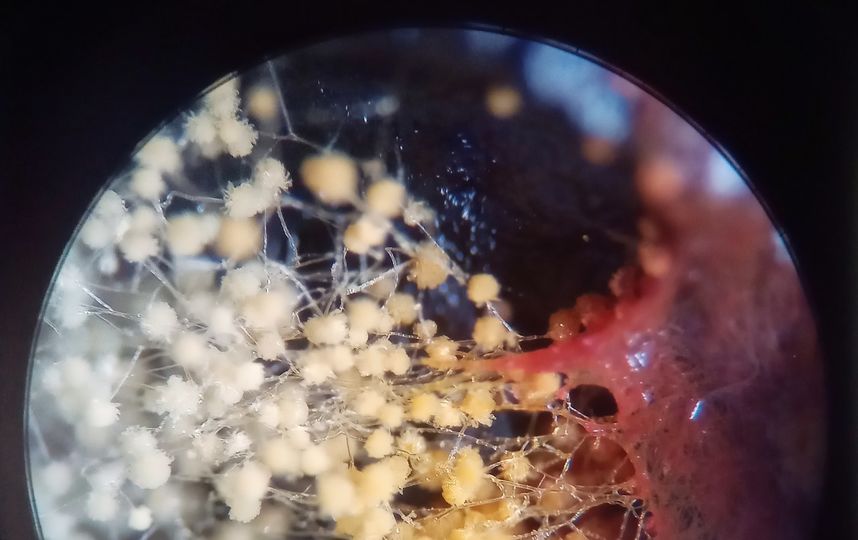 "Плесневелые грибы". Фото FOMINYKHGREG, Предоставлено организаторами