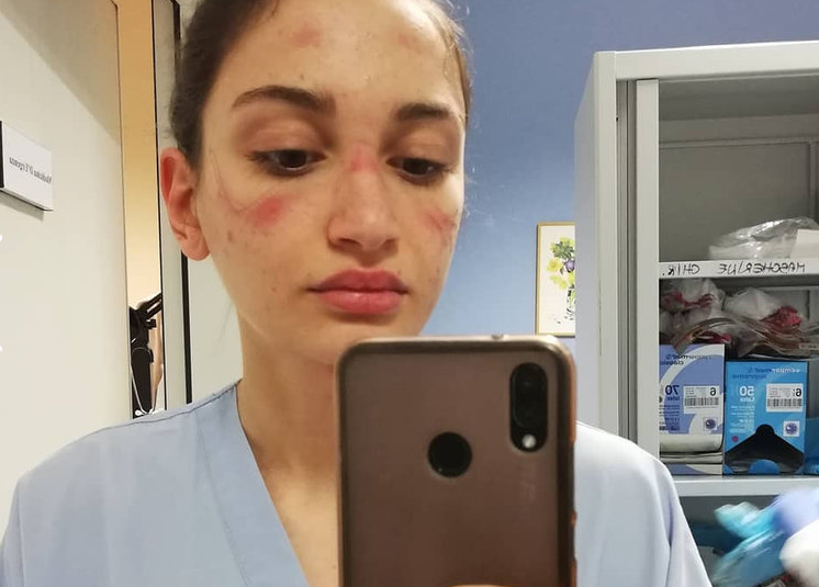 Медсестра Алессия Бонари. Фото Фото instagram