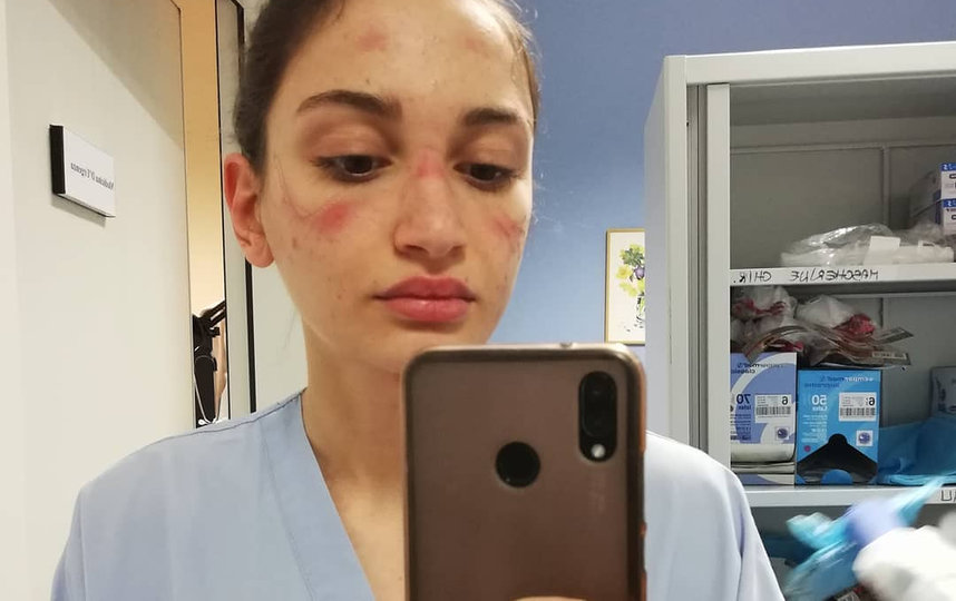 Алессия Бонари. Фото instagram