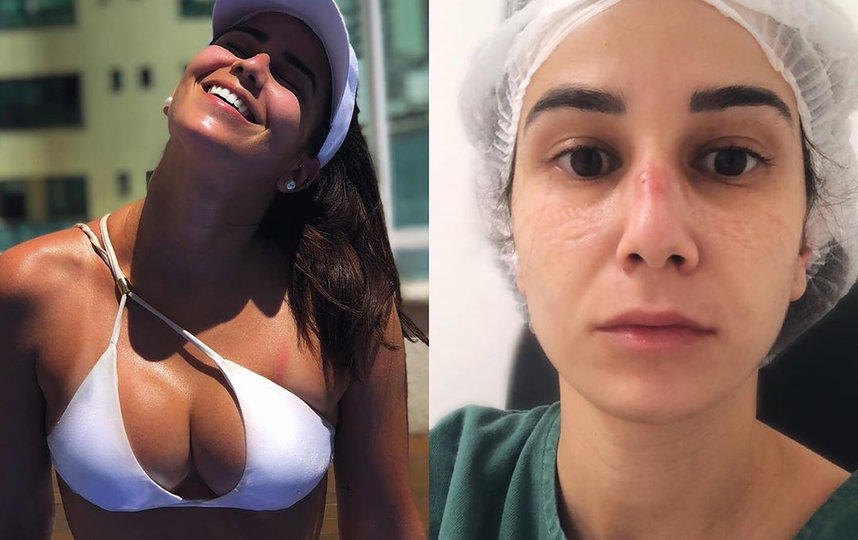 В ответ на критику медики публикуют свои фотографии в бикини. Фото Instagram @ladaisysanchez