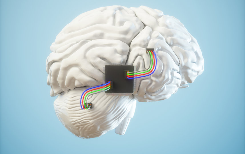 Эксперты считают, что использование мозговых имплантатов может быть рискованным, но преимущества перевешивают это. Фото iStock