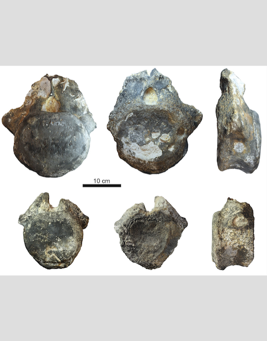 Те самые позвонки. Фото Николай Зверьков, "Metro"