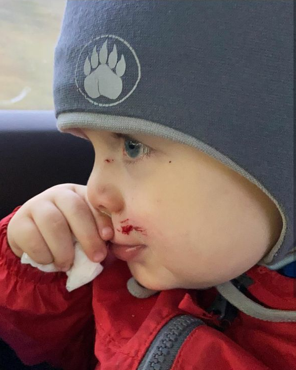 Салон машины и пострадавший ребёнок после происшествия. Фото предоставлены героем материала