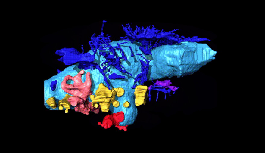 Компьютерная реконструкция эндокаста мозговой полости и сосудов головы анкилозавра Bissektipelta archibaldi. Розовый цвет – внутреннее ухо, жёлтый – нервы, красный – крупные артерии, синий – вены и мелкие артерии, голубой – эндокаст мозговой полости. Фото предоставили авторы исследования, "Metro"