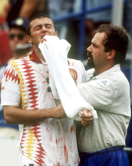 В 1994 году на чемпионате мира в США Италия обыгрывала Испанию со счётом 2:1. Защитник итальянцев Мауро Тассотти сломал нос Луису Энрике ударом локтя. Тот эпизод остался без внимания рефери. Однако постфактум ФИФА изучила момент и вынесла нарушителю дисквалификацию на 8 матчей. Фото Getty