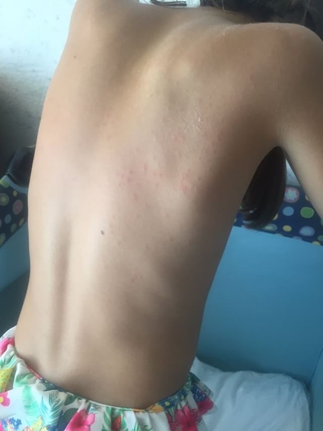 Дети, пострадавшие от вируса Коксаки. Фото Фото предоставлено Марией Сакович.