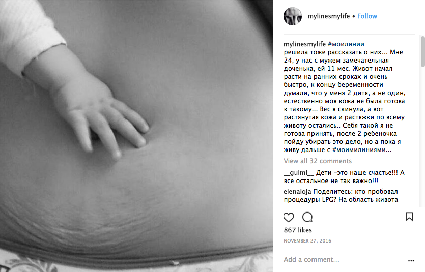 Истории девушек на @mylinesmylife. Фото www.instagram.com/mylinesmylife