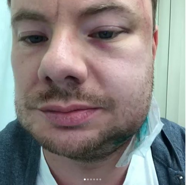Избитый DJ Smash записал видеообращение