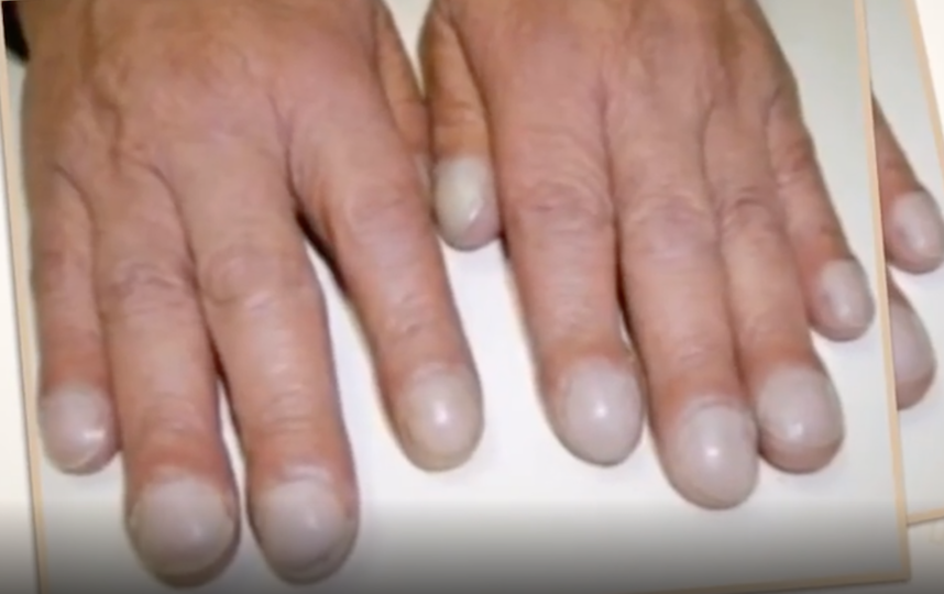 Ногти "часовые стёкла". Фото скриншот instagram.com/malysheva.live/?hl=ru