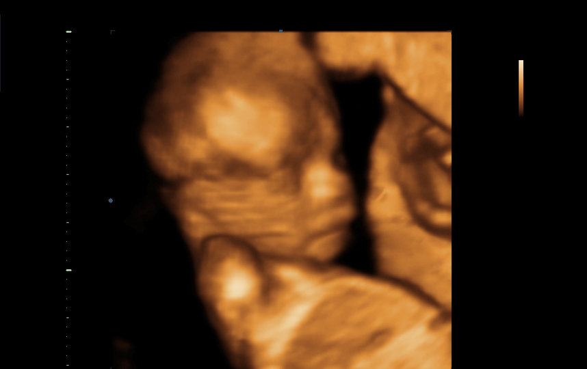 Будущая радость семьи Локвуд. Фото предоставила Бреанна Локвуд