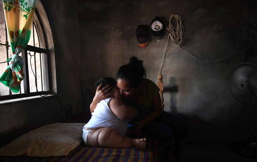 Десятимесячный ребёнок из Мексики весит 28 килограмм – фото