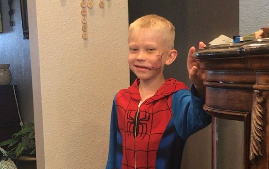 Бриджеру наложили около 90 швов. Фото Instagram @nicolenoelwalker