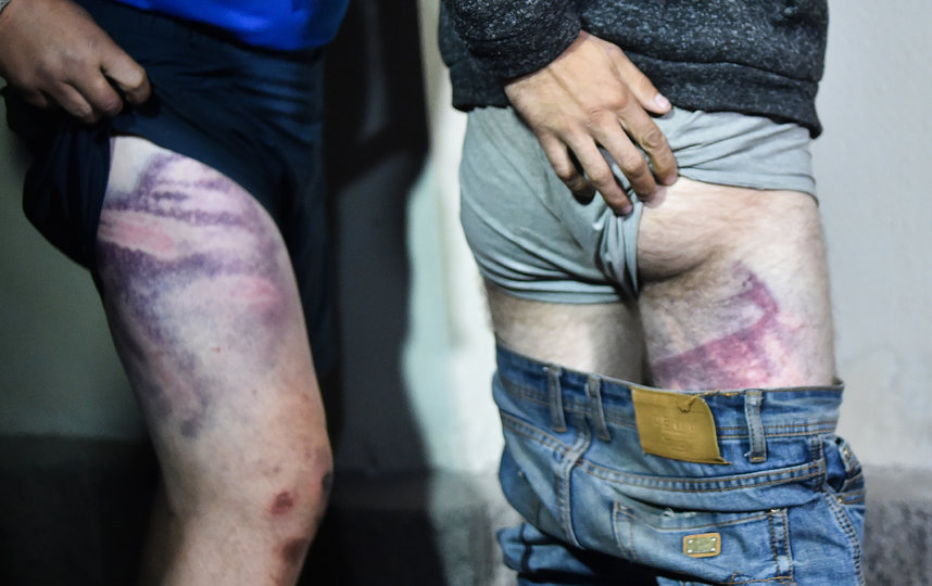 Александр Лукашенко уверен, что 60% фото пострадавших от действий правоохранителей при разгоне акций протеста в республике после президентских выборов являются постановочными. Фото AFP