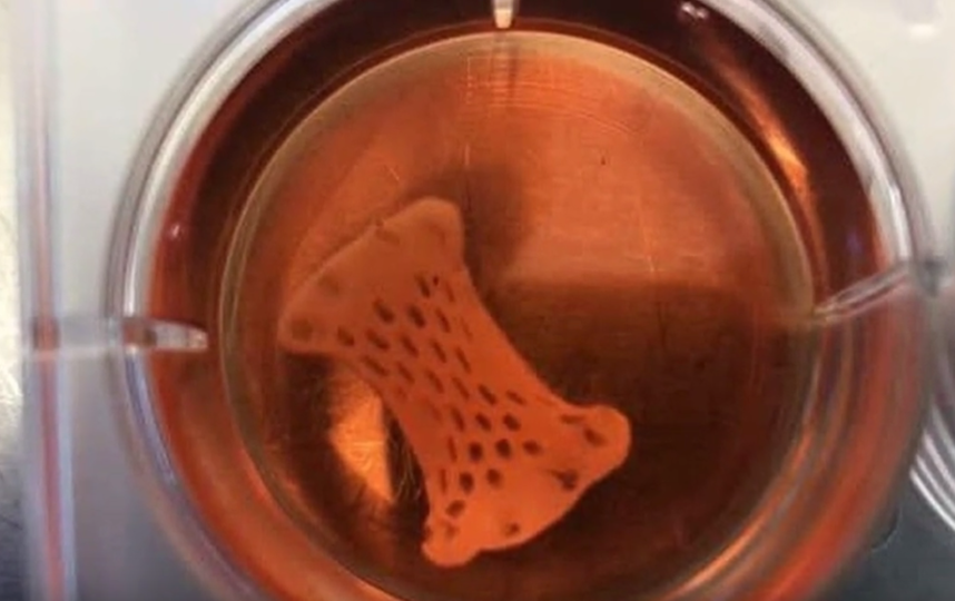 "Живой" пластырь выращивают в лаборатории из образца клеток пациентов. Фото Скриншот https://www.youtube.com/watch?v=A762ZLLoguw, Скриншот Youtube