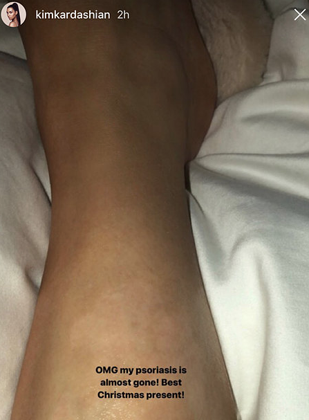 Нога Ким Кардашьян. Фото www.instagram.com/kimkardashian