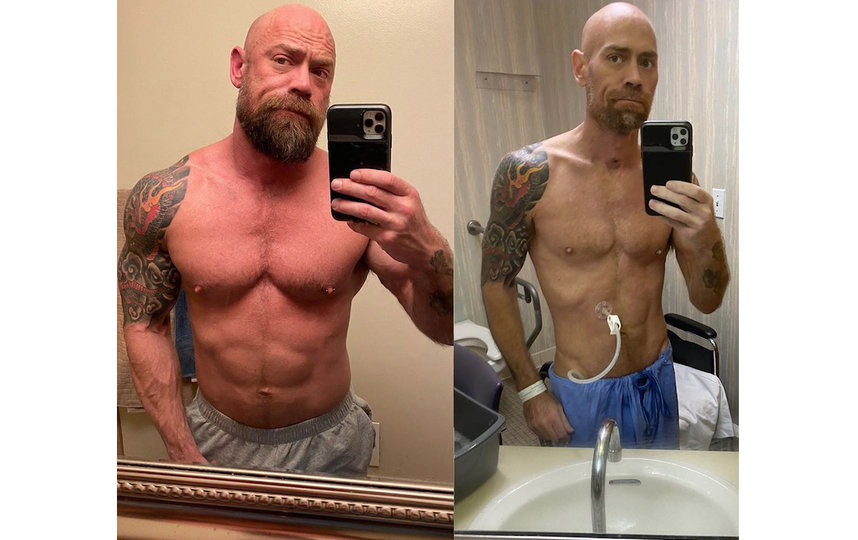 Майк Шульц за месяц до болезни и сразу после выздоровления. Фото instagram.com/thebearded_nurse