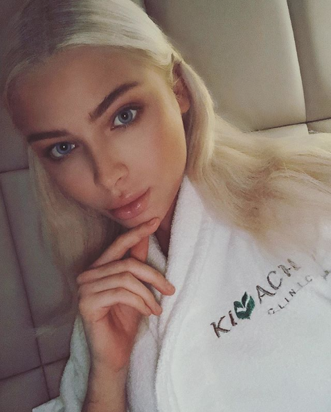 Алёна Шишкова. Фото Скриншот Instagram: missalena.92