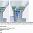 Duravit Durastyle Dry писсуар без использования воды (2808300000)